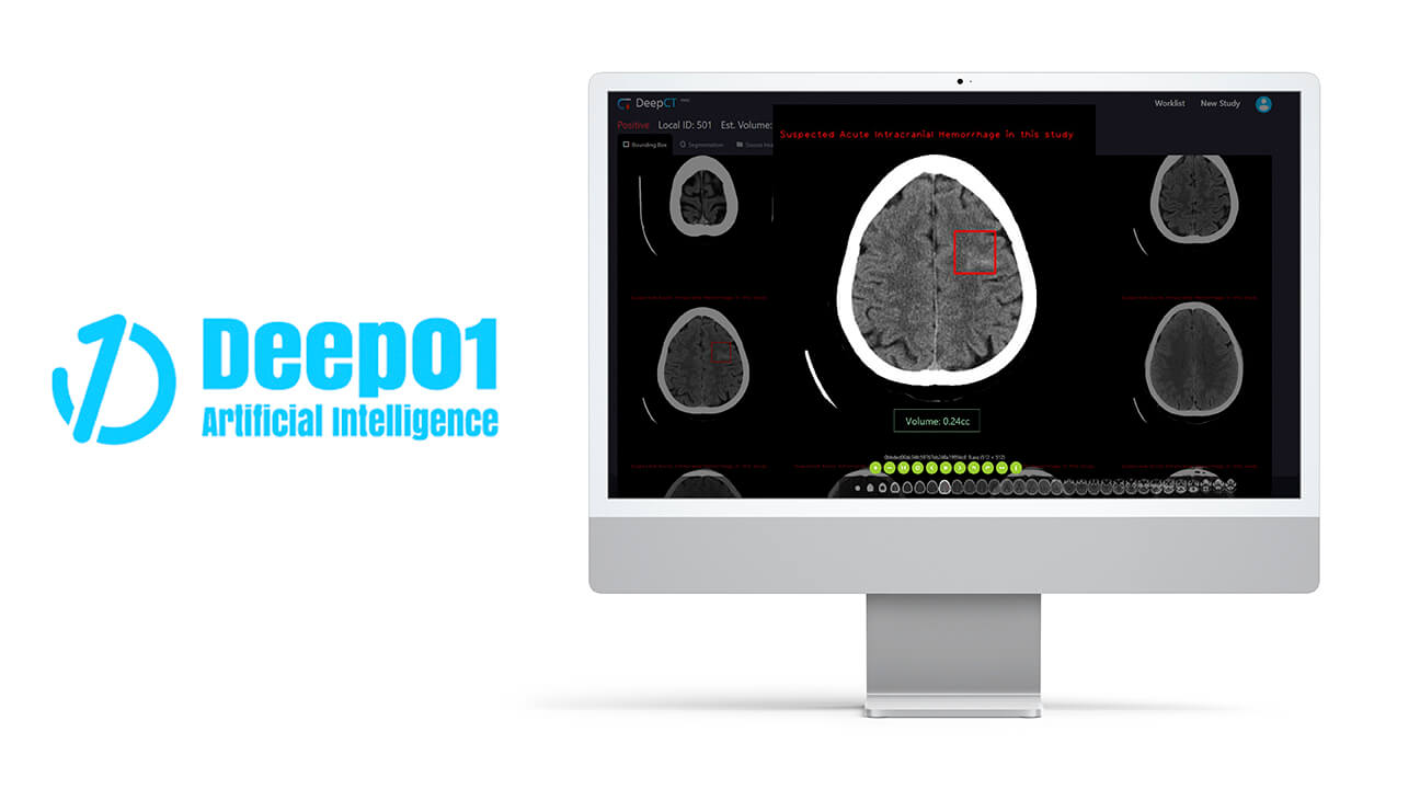 Winner small image - Deep01